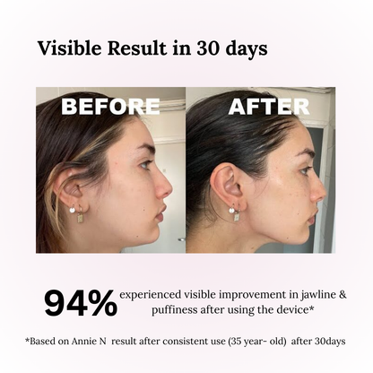 "V-Glow Pro Face Massager™