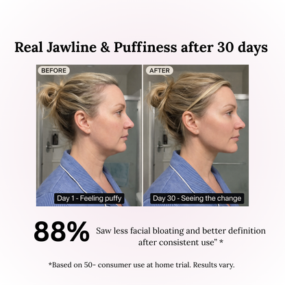 "V-Glow Pro Face Massager™